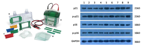 Western Blot|蛋白免疫印迹|西宝生物-专业技术服务商-热线：4000218158