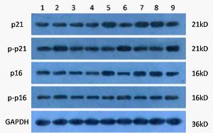 荧光定量PCR |多肽合成|蛋白表达|多克隆抗体|全基因合成|免疫印迹|西宝生物-热线4000218158