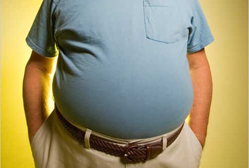 肥胖人士患2型糖尿病的风险较大 肥胖人士患2型糖尿病的风险较大