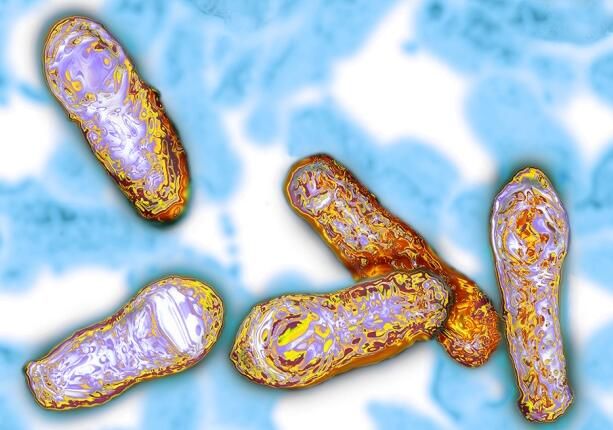 科学家首次在细菌中发现朊病毒样蛋白