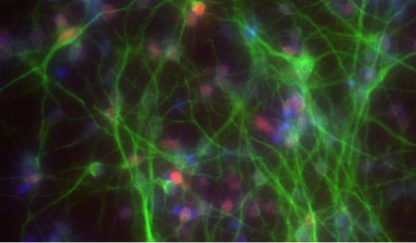 科学家利用CRISPR-Cas9技术成功构建出细胞疾病模型 科学家利用CRISPR-Cas9技术成功构建出细胞疾病模型