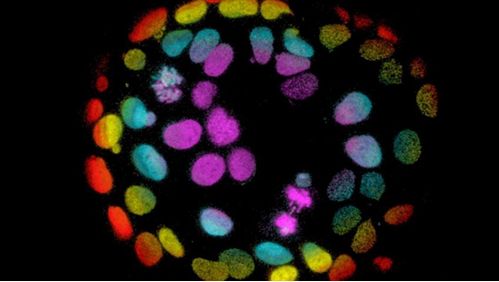 工程化人类结肠组织模型或助力癌症研究 工程化人类结肠组织模型或助力癌症研究
