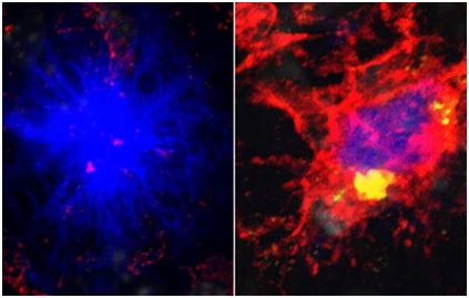 Cell：揭示<font color='red'>小胶质细胞</font>能量短缺为何会增加阿尔茨海默病风险