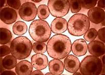 日本利用iPS细胞将量产血小板