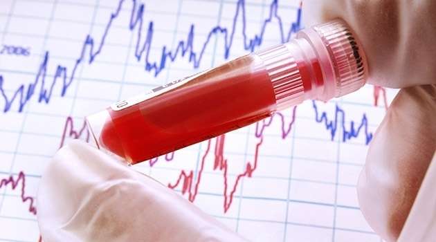 重磅！科学家开发出能准确高效预测个体<font color='red'>冠心病风险</font>的新型血液检测技术