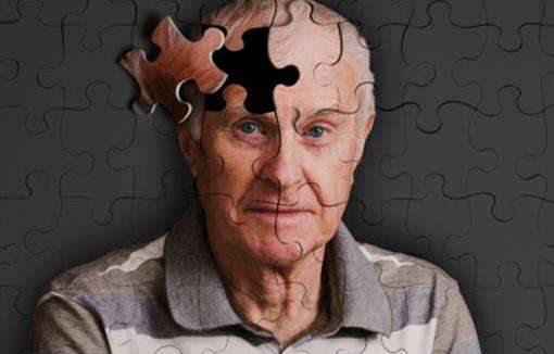俄罗斯和瑞典科学家发现高效阿尔茨海默症诊断试剂
