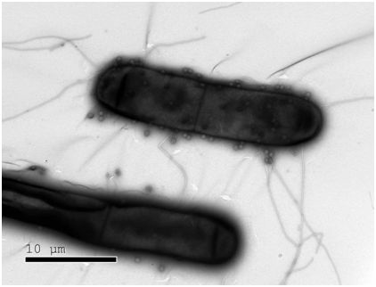 Science：发现10种新型<font color='red'>细菌免疫防御系统</font>，有望开发出下一代基因编辑工具