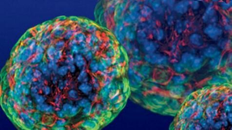 Cell Rep：糖尿病新疗法来啦！特殊的胰腺干细胞有望再生胰腺β细胞对葡萄糖产生反应！