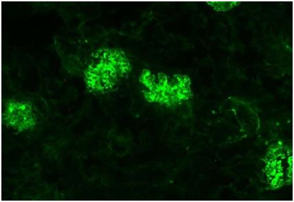 Science：细胞毒性T细胞竟让自身免疫疾病更加严重！