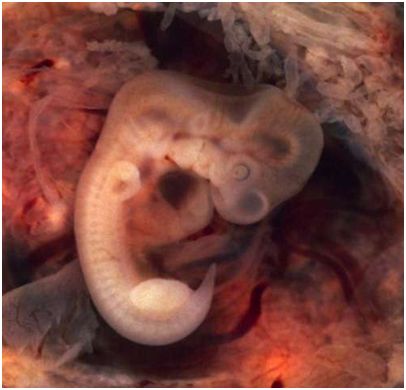 Nature：首次研究塑造人类胚胎的最早决定