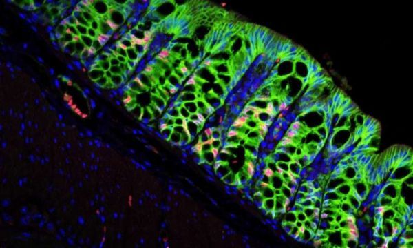 Nature：科学家发现每天产生100亿肠细胞的干细胞巢