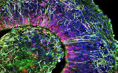 大脑类器官的新型培育方法