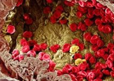 科学家发现表观遗传靶标SIRT6激动剂可抑制肝癌增殖