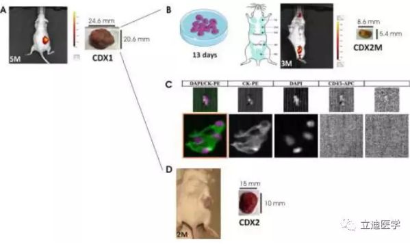 最新研究：科学家借助循环肿瘤<font color='red'>细胞移植</font>模型揭示三阴性乳腺癌的转移机制