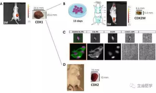 最新研究：科学家借助循环肿瘤细胞移植模型揭示三阴性乳腺癌的转移机制