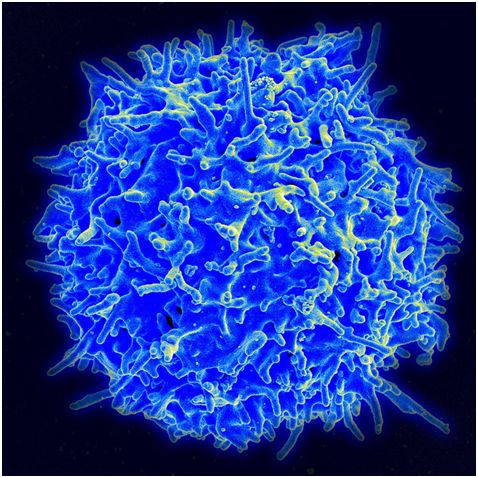 Science：重大进展！鉴定出一种引发过敏反应的免疫细胞亚型---Tfh13细胞