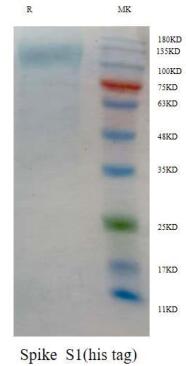 新型冠状病毒S1蛋白(His Tag)|传染病|西宝生物科技（上海）股份有限公司-咨询电话：400-021-8158