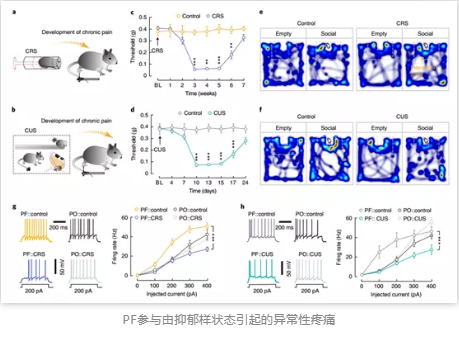 PF参与由抑郁样状态引起的异常性疼痛