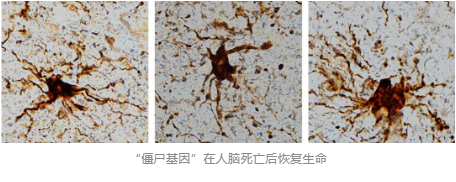 “僵尸基因”在人脑死亡后恢复生命