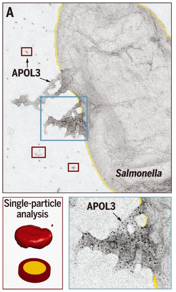 APOL3的负染色电子显微镜检查逃
