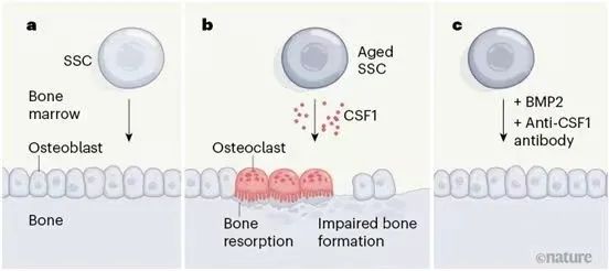 《Nature》重磅！衰老的骨骼干细胞会延缓骨折愈合,并促进炎症发展加速全身衰老！