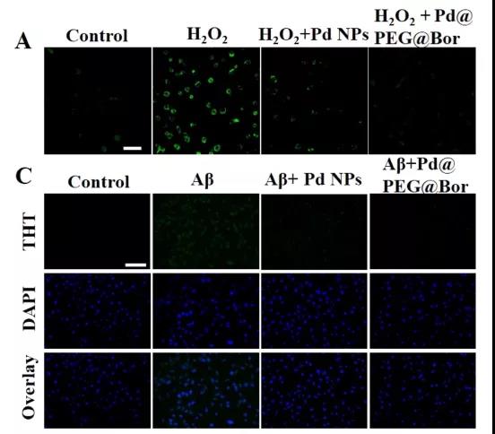 图注：Pd@PEG@Bor消除活性氧并使体外Aβ含量下降