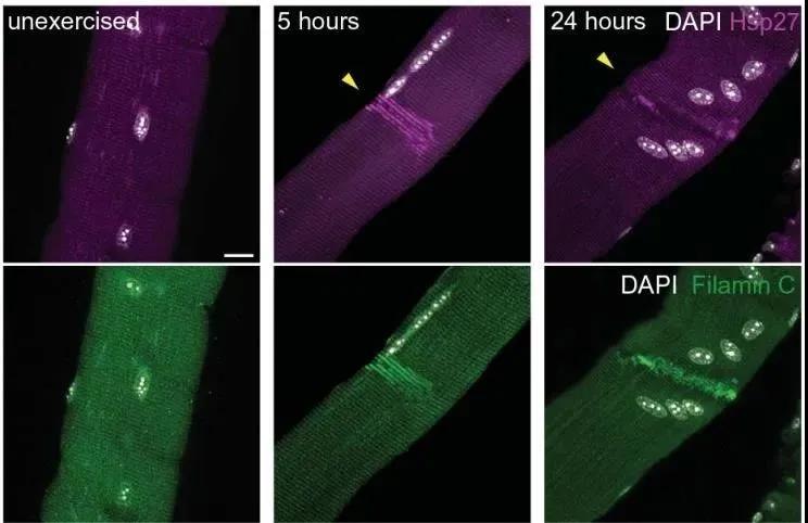 图注：肌肉损伤后，HSP27（上）和FLNC（下）在受损区域的聚集情况