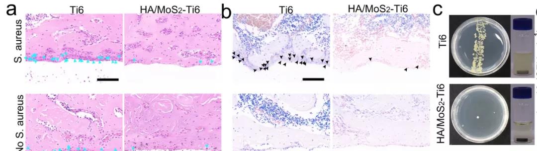图注：HA/MoS2-Ti6种植体的体内抗菌效果