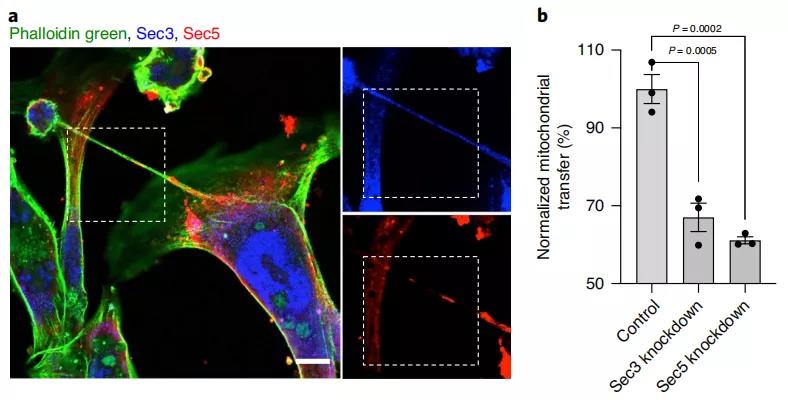 乳腺癌细胞和免疫细胞共培养的免疫标记，Sec3和Sec5与肌动蛋白细胞骨架共定位（Sec3蓝色，Sec5红色，肌动蛋白染色为球藻绿），缺少Sec3或Sec5可以减少免疫细胞和癌细胞之间的线粒体运输