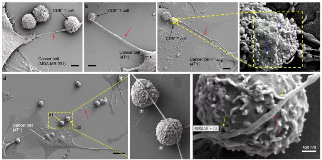 癌细胞和免疫细胞通过纳米管状结构物理连接
