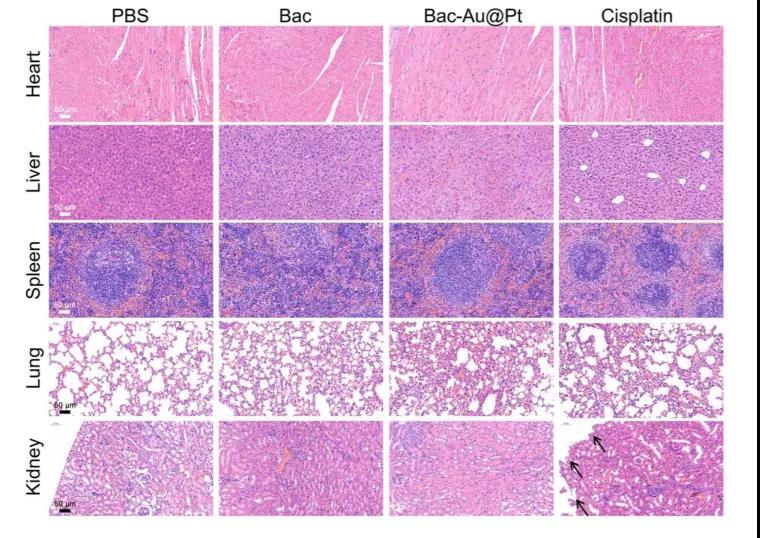心脏、肝脏、脾脏、肺和肾脏的H&E染色图像。黑色箭头表示肾脏的损伤