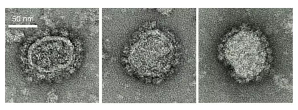  三种代表性 mRNA 表达的 Env-Gag VLP