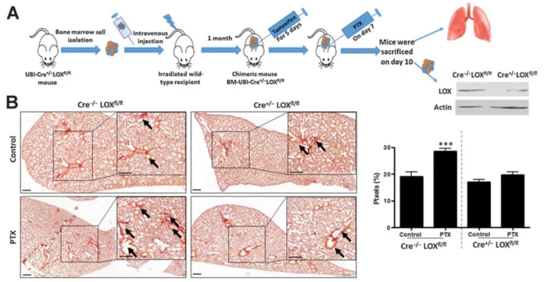 骨髓LOX缺陷嵌合小鼠的构建示意图以及PTX处理后肺组织胶原蛋白和弹力蛋白染色（图源：Cancer Research）
