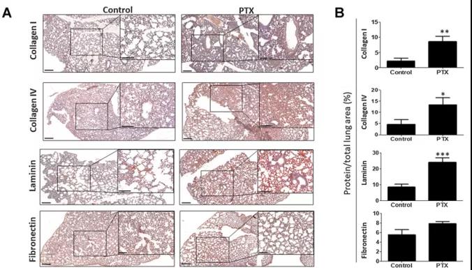 免疫组织化学染色显示PTX处理后小鼠肺组织ECM主要成分表达变化（图源：Cancer Research）