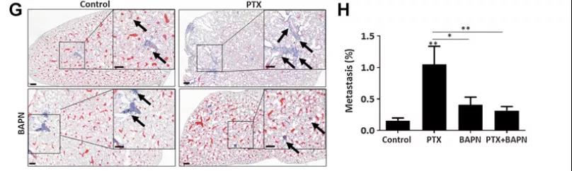 对照药物、PTX、LOX抑制剂、PTX和BAPN联合治疗对转移灶的影响（图源：Cancer Research）