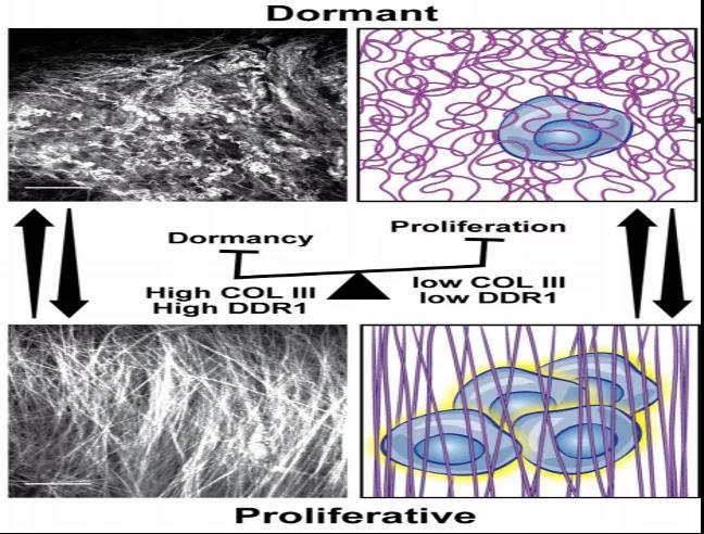 休眠型肿瘤细胞与增殖型肿瘤细胞（图源：Nature Cancer）