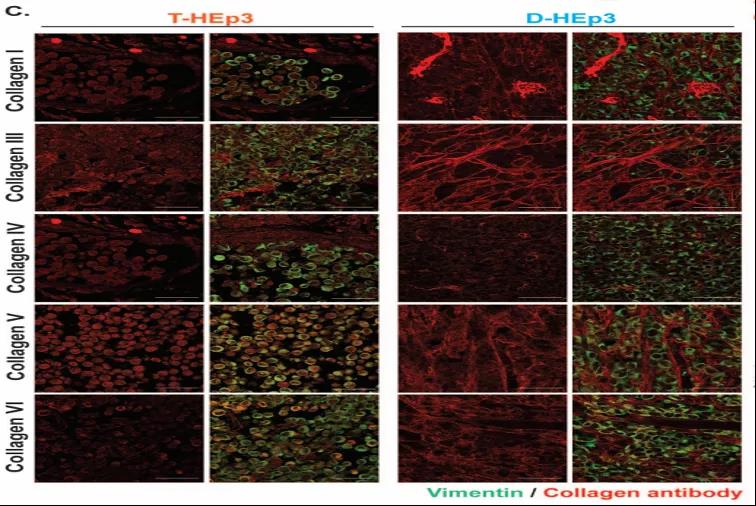 T-HEp3（增殖期肿瘤）和D-HEp3（休眠期肿瘤）的胶原蛋白类型对比（图源：Nature Cancer）