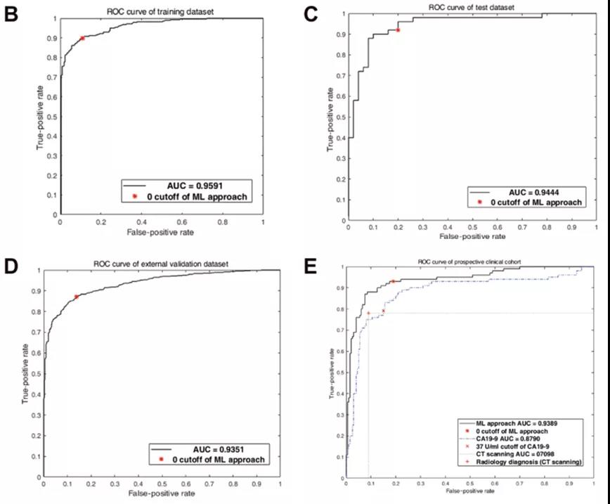 ML辅助代谢型PDAC检测方法在验证研究训练数据集&内部验证数据集&外部验证数据集&前瞻性临床队列中的ROC曲线（图源：Science Advances）