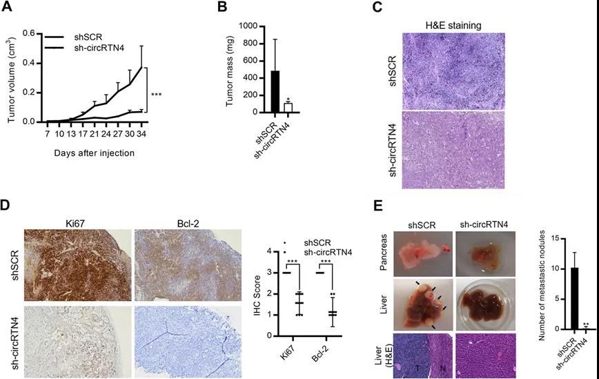 circRTN4促进PDAC肿瘤生长和肝转移（图源: Molecular Cancer）