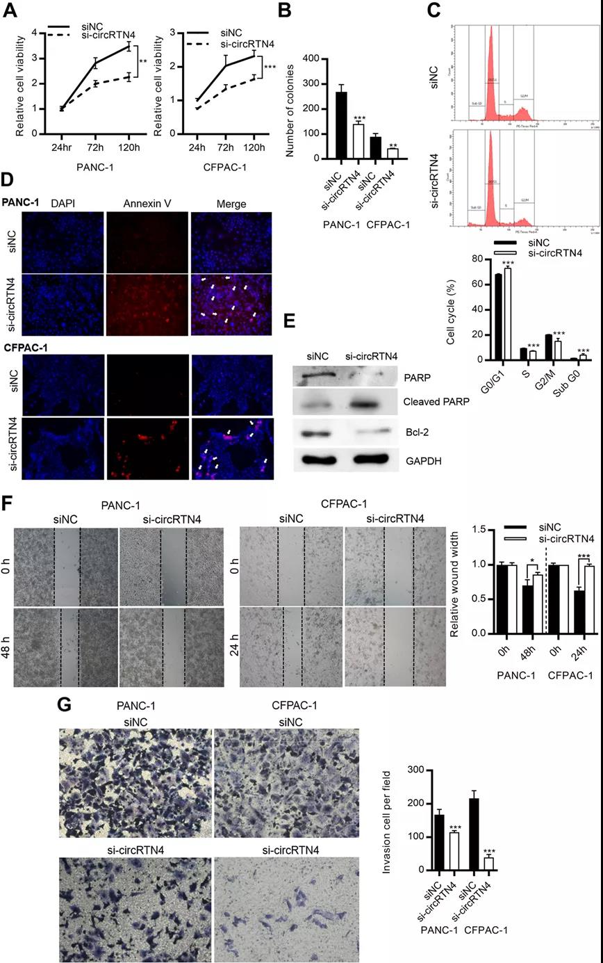 circRTN4促进PDAC细胞的生长、迁移和侵袭（图源: Molecular Cancer）