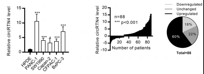  circRTN4在PDAC细胞和原发性肿瘤中上调（图源: Molecular Cancer）   