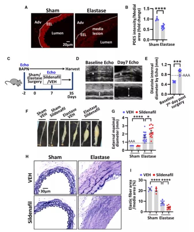 小鼠AAA组织的中层平滑肌细胞SMC中 cGMP 水解PDE5A的表达降低（图源：JAHA）