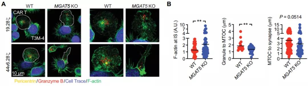 敲除MGAT5后免疫突触与功能性细胞溶解情况（图源：STM）