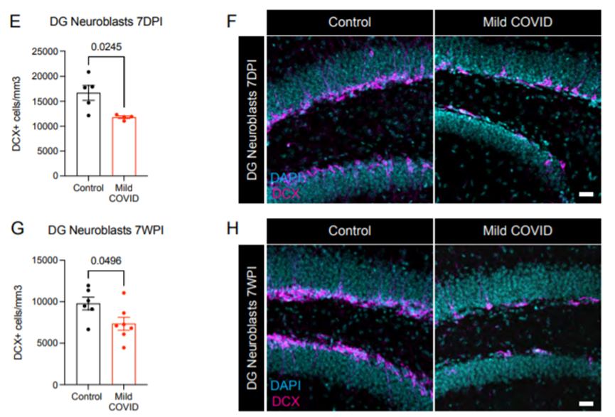 感染后7天和7周小鼠齿状回的神经母细胞定量及代表性共聚焦显微图像（图源：bioRxiv）