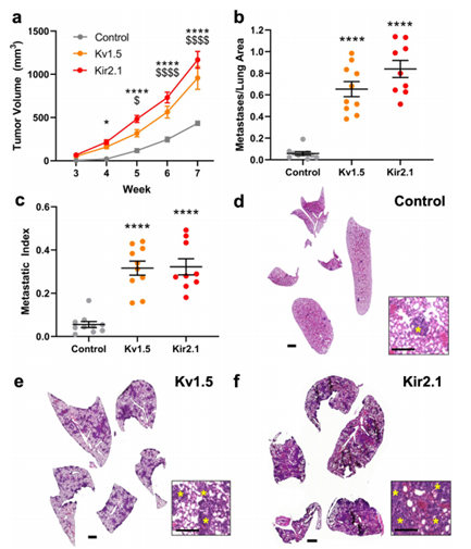 K+通道驱动RMP超极化增加TNBC肿瘤生长和转移（图源：[2]）