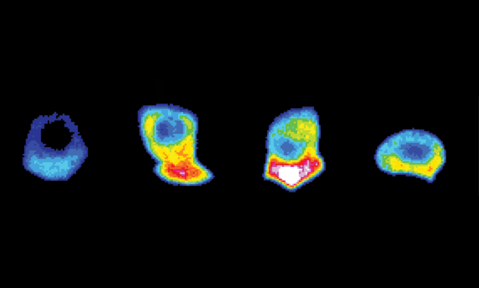 Developmental Cell：为入侵细胞的“前线”提供燃料