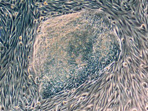 蛋氨酸亚砜还原酶A (MSRA)在转移性胰腺癌细胞中的表达水平异常低