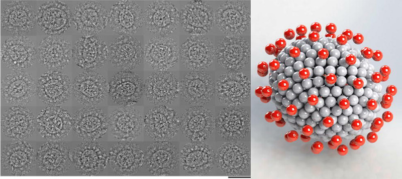 多种形性SARS冠状病毒粒子的低温电子显微照片