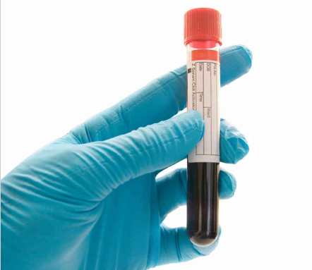 新型血液检测手段提前诊断1型<font color='red'>糖尿病</font>