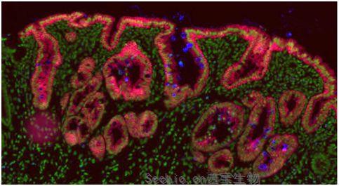 Nature：挑战常规！胎儿中的所有肠道细胞都潜力发育成<font color='red'>肠道干细胞</font>